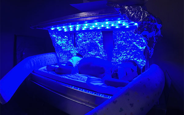 Phototherapy in Africa