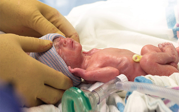 VLBW Infant Care